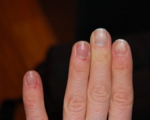 (yes, I have bad cuticles... I know this)